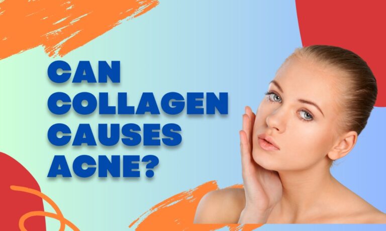 CAN COLLAGEN CAUSES ACNE